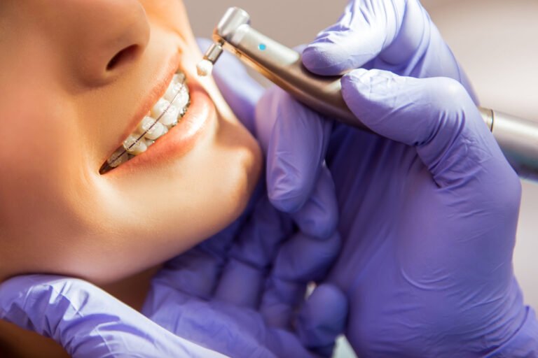 Medico dentista al lavoro su apparecchio ortodontico tradizionale