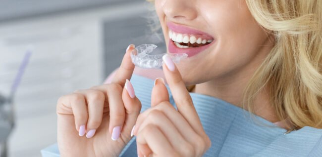 Unrecognizable female patient holding invisible braces or trainer, panorama apparecchio trasparente
