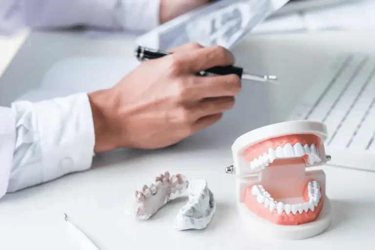 Scrivania di un ortodontista con una impronta dentale (arcata inferiore) ed un modellino completo con le due arcate dentali. Nello specifico utilizzate per parlare di classificazione di angle